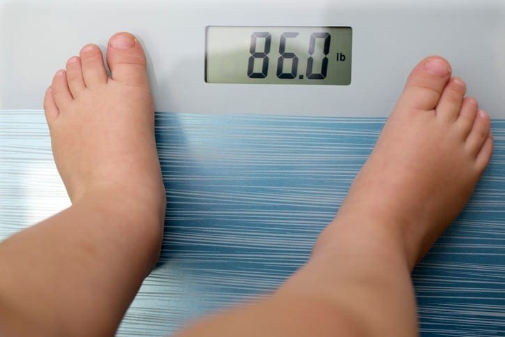 childhood obesity